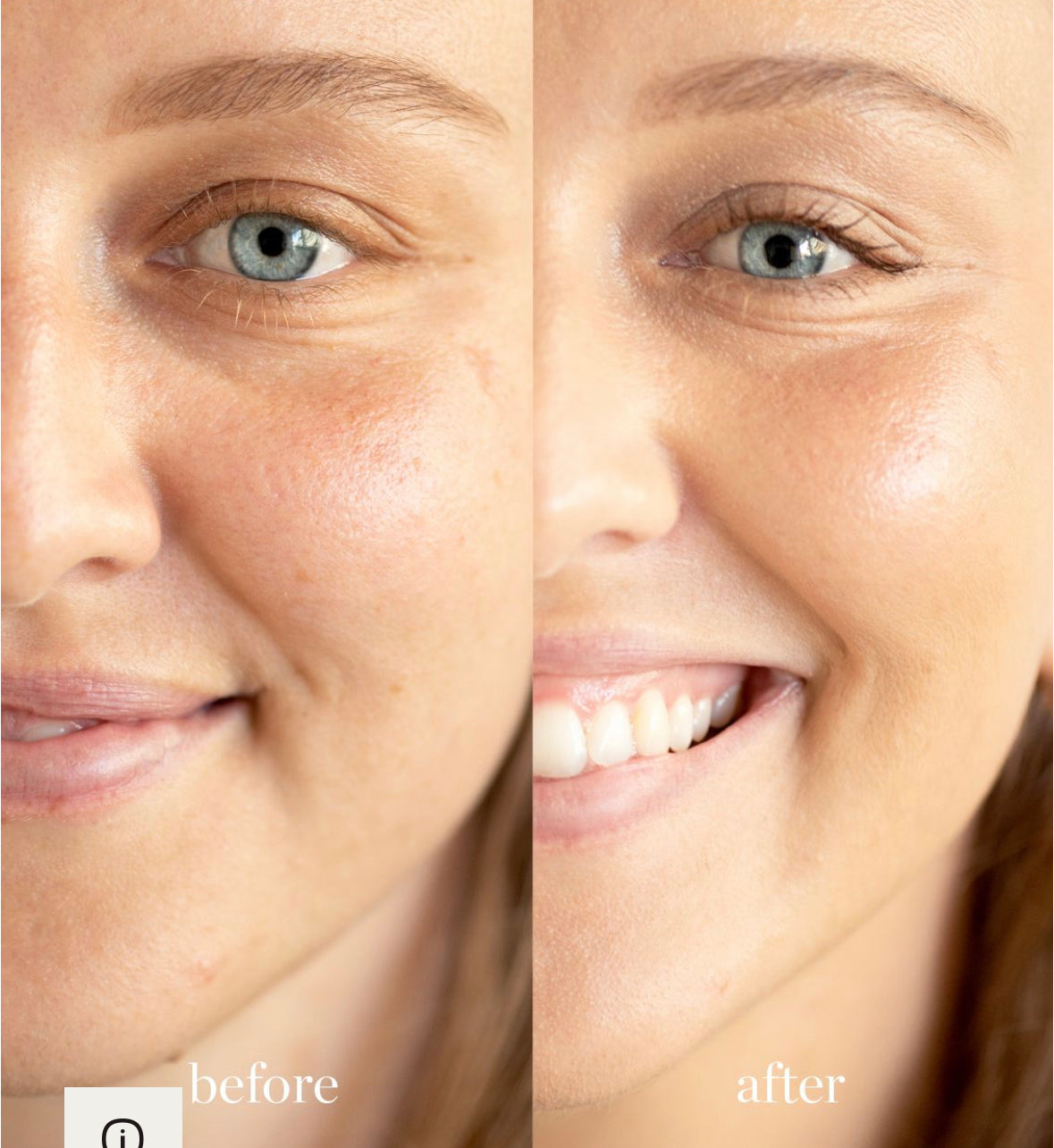 Corrector con lichi, tono Tres